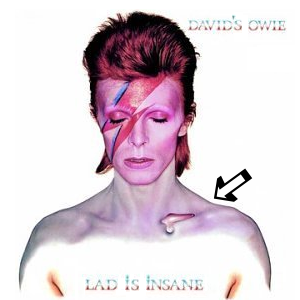 Album cover parody of Aladdin Sane by David Bowie